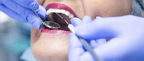 Best Emergency Care for Gum Disease in Chatsworth, IL