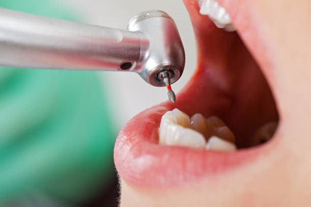 Best Dental Abscess Treatment in Chatsworth, IL